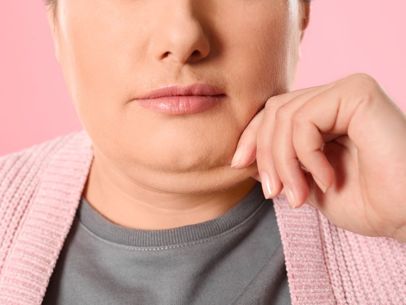 Lipo de papada em recife redefina o contorno facial do rosto